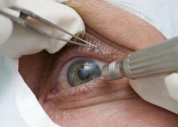 Saúde Consultas regulares ao médico podem afastar risco de glaucoma