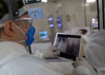 Covid-19: Brasil registra 469.388 óbitos e casos vão a 16.803.472