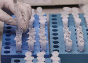 UFRJ desenvolve teste de baixo custo para detecção de covid-19