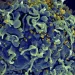 Médicos anunciam 4º caso de cura de HIV