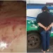 Mãe é presa suspeita de torturar filha com cipó após ela ‘fazer bagunça’