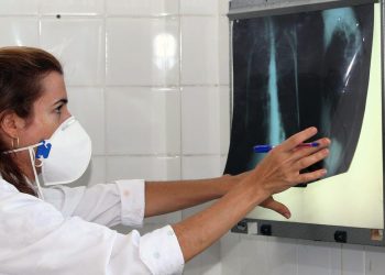 Governo cria comitê para reduzir casos de tuberculose até 2030