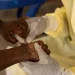 África declara emergência em saúde pública por epidemia de mpox